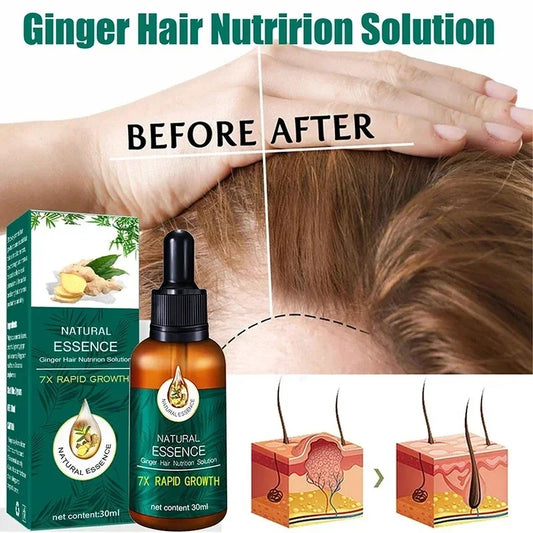 Hair Growth Ginger Anti-hair Loss Hair Maintenance 30ml